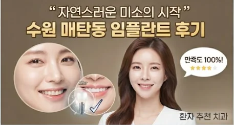 매탄동 임플란트